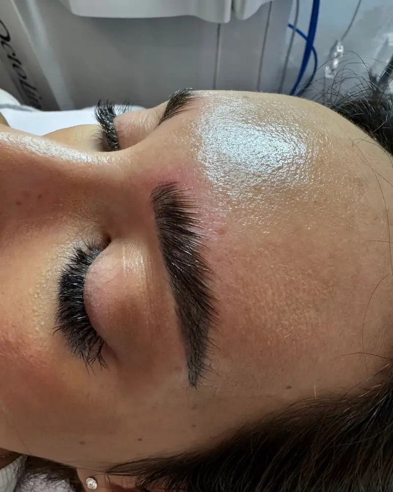 Facials and glow treatment